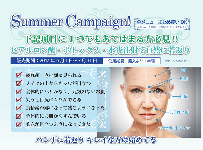 サマーキャンペーン