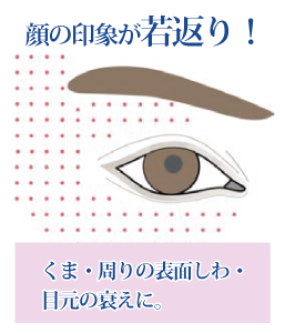 RRS ヒアアイズ